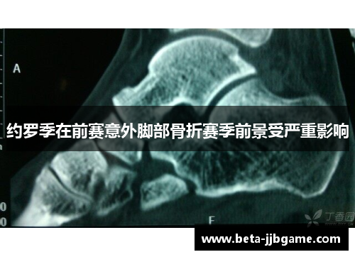 约罗季在前赛意外脚部骨折赛季前景受严重影响 约罗季在前赛意外脚部骨折赛季前景受严重影响